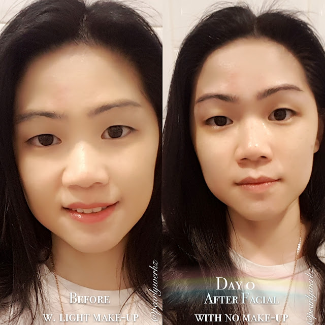 The Benefits of Professional Treatments