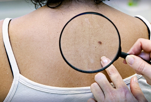 Dietary Changes: Fueling Clear Skin from Within