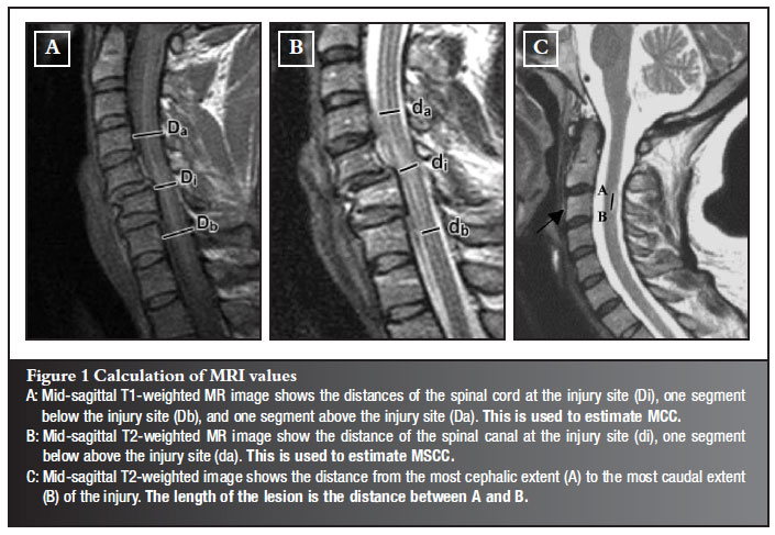 Preventative Measures for Cervical Disc Herniation