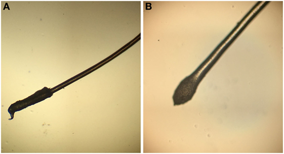 The Science Behind Hair Loss