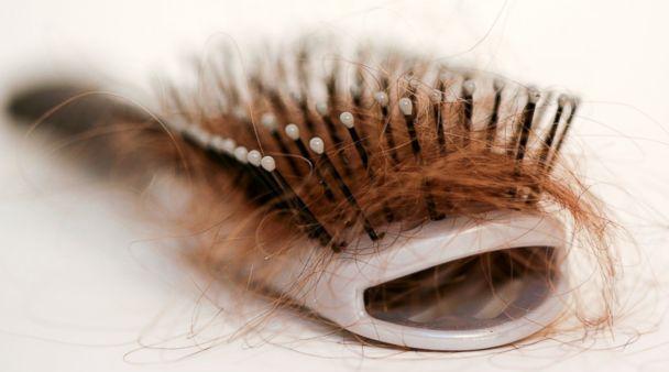 Preventive Measures and Treatments for Hair Loss