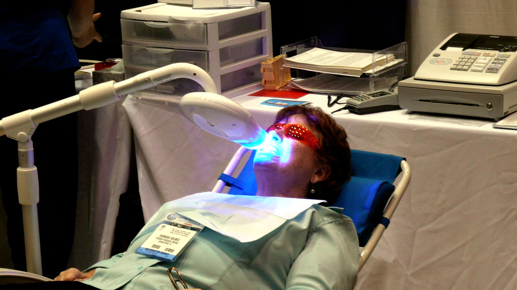 Professional Teeth Whitening: What to Expect at the Dentist